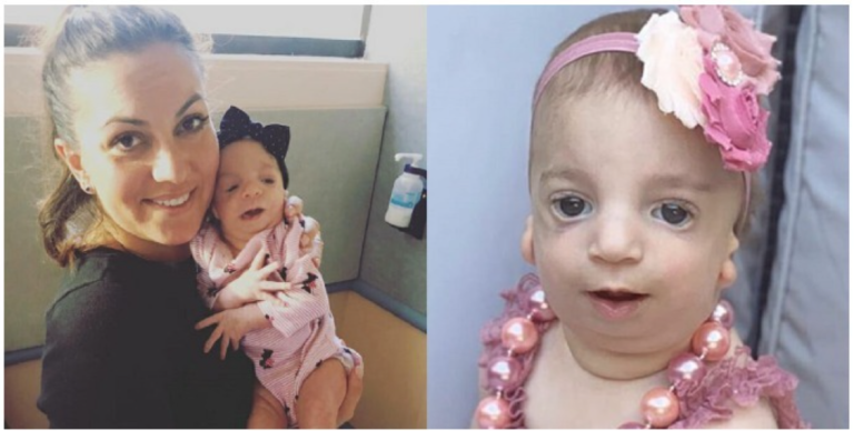 « Son arrivée n’a pas été célébrée » Des parents partagent leur réaction déchirante face à leur nouveau-né atteint d’une maladie génétique rare