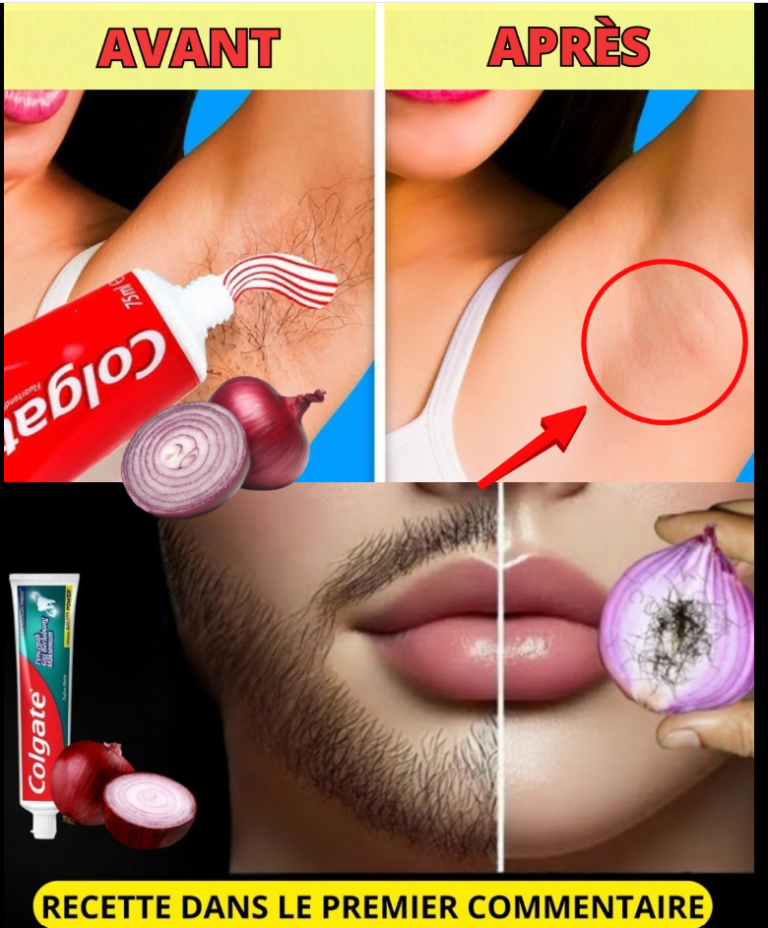 Épilation indolore en 2 minutes : solution permanente avec des ingrédients naturels à la maison