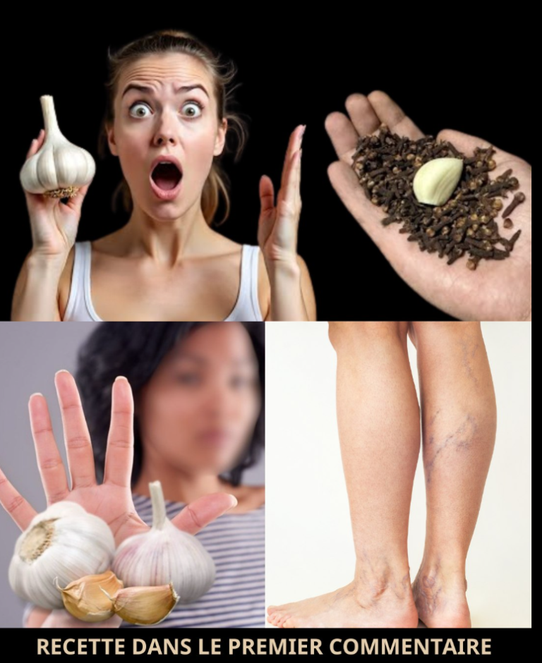 🧄 Ail et clou de girofle : le puissant remède naturel contre les douleurs aux jambes, les varices et l’arthrite