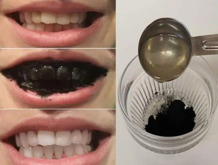 Les effets du charbon actif sur votre corps au-delà du blanchiment des dents