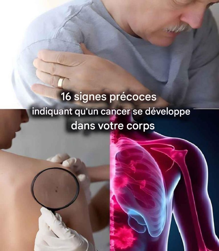 16 signes précoces indiquant qu’un cancer se développe dans votre corps.