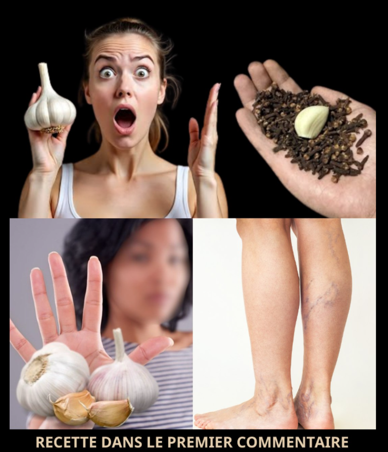 🧄 Ail et clou de girofle : le puissant remède naturel contre les douleurs aux jambes, les varices et l’arthrite