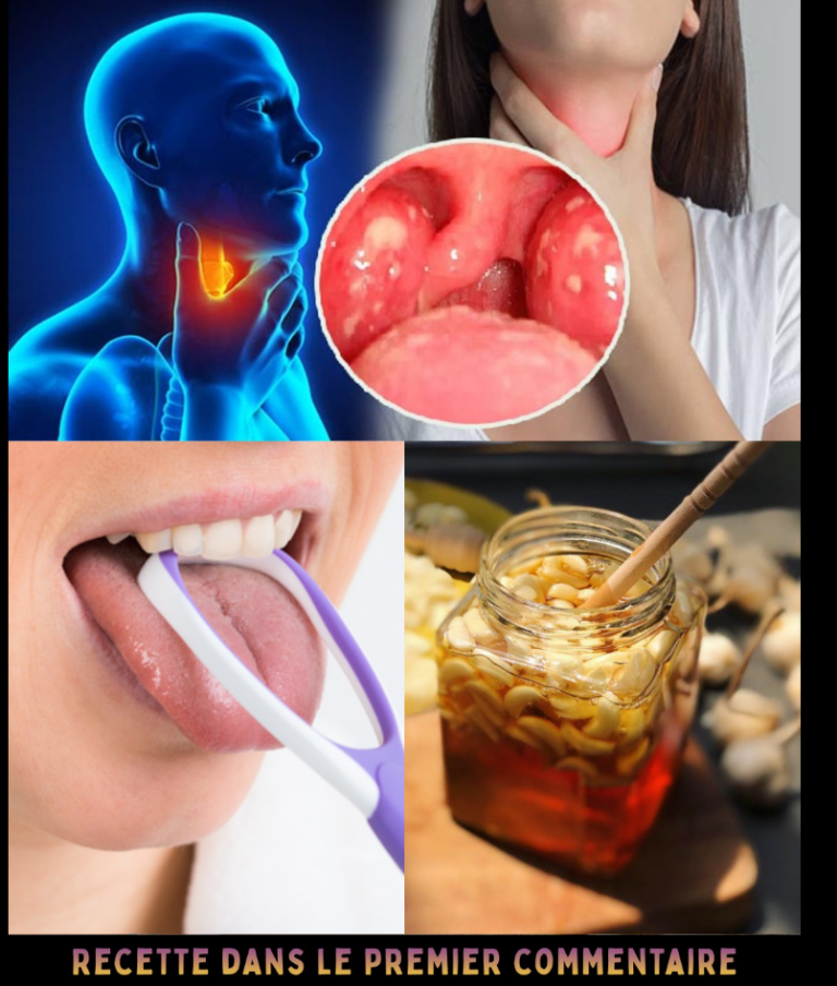 L’ail élimine 14 types de bactéries et 13 infections : l’antibiotique naturel le plus puissant