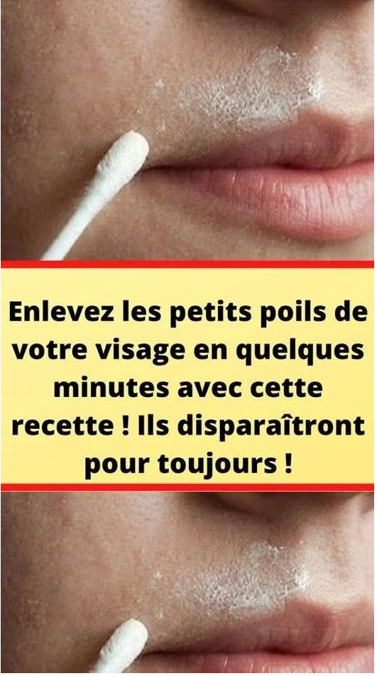 Cette recette naturelle éliminera définitivement les poils de votre visage