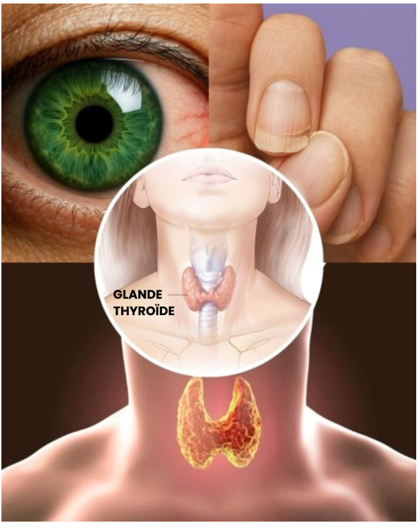 10 signaux cachés indiquant que votre thyroïde ne fonctionne pas correctement